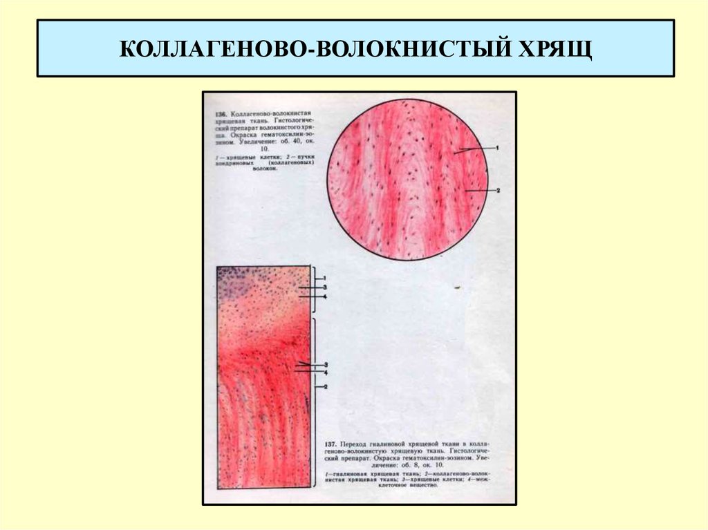 Волокнистый хрящ гистология рисунок