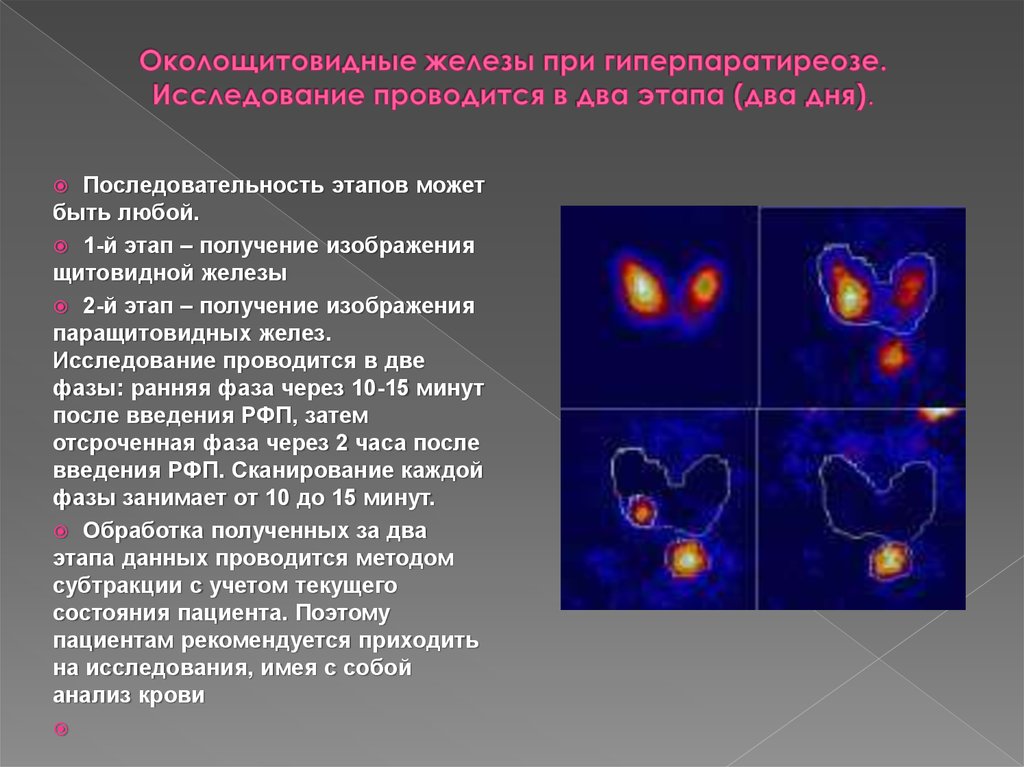 Сцинтиграфия щитовидной подготовка