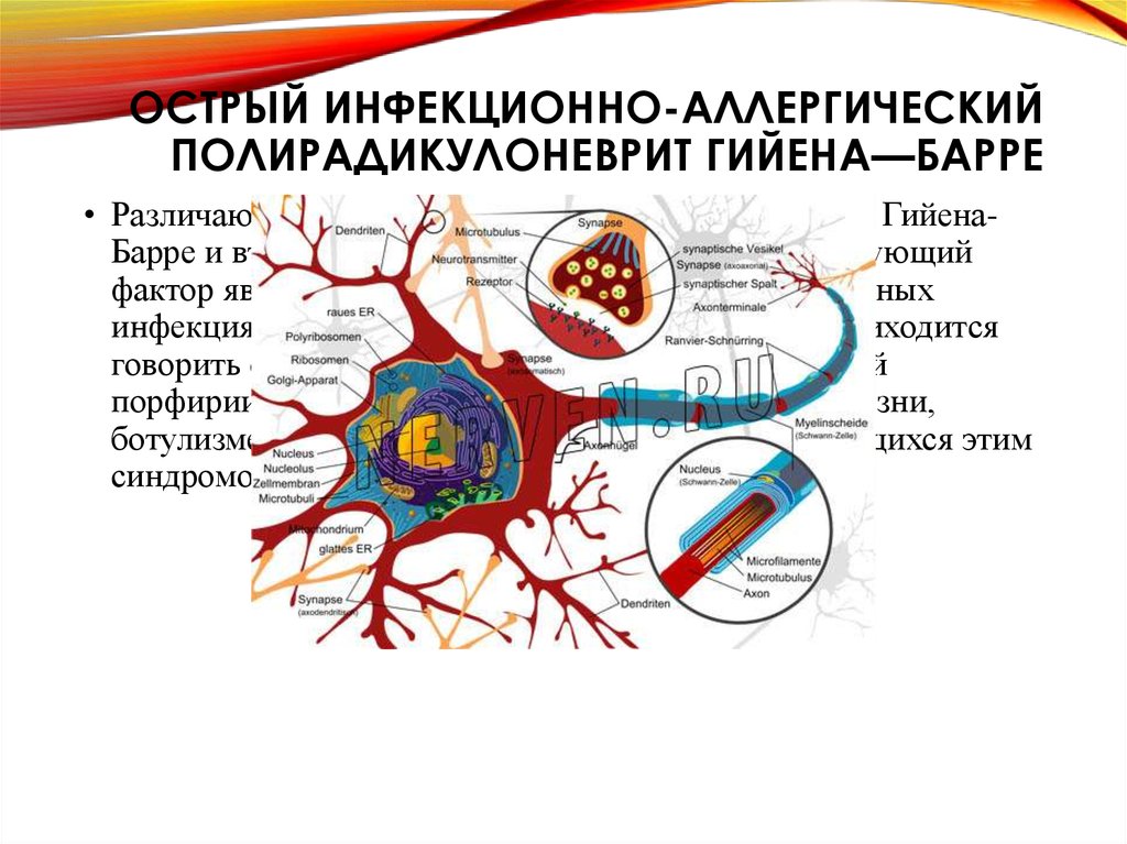 Симптом гийена барре. Полирадикулоневрит Гийена-Барре. Синдром Гийена Барре патогенез. Острая полинейропатия Гийена-Барре. Острый инфекционный полирадикулоневрит.