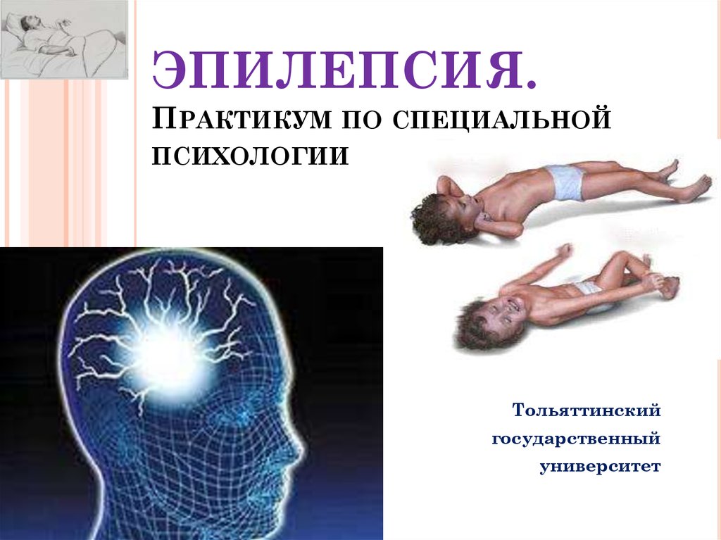 Исследование эпилепсии. Эпилепсия презентация. Психологическая эпилепсия.