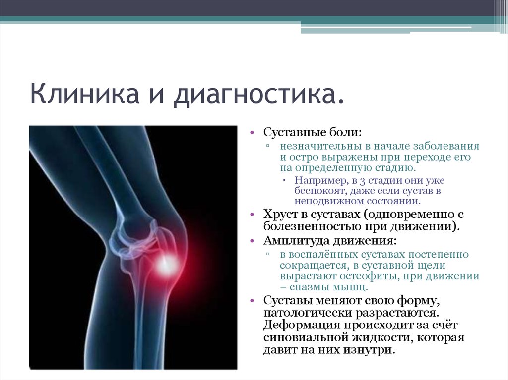 Остеоартроз что это такое как лечить. Деформирующий остеоартроз коленных суставов клиника. Деформирующий остеопороз коленного сустава. Остеоартрит коленных суставов диагноз. Деформирующий артрит локтевого сустава.