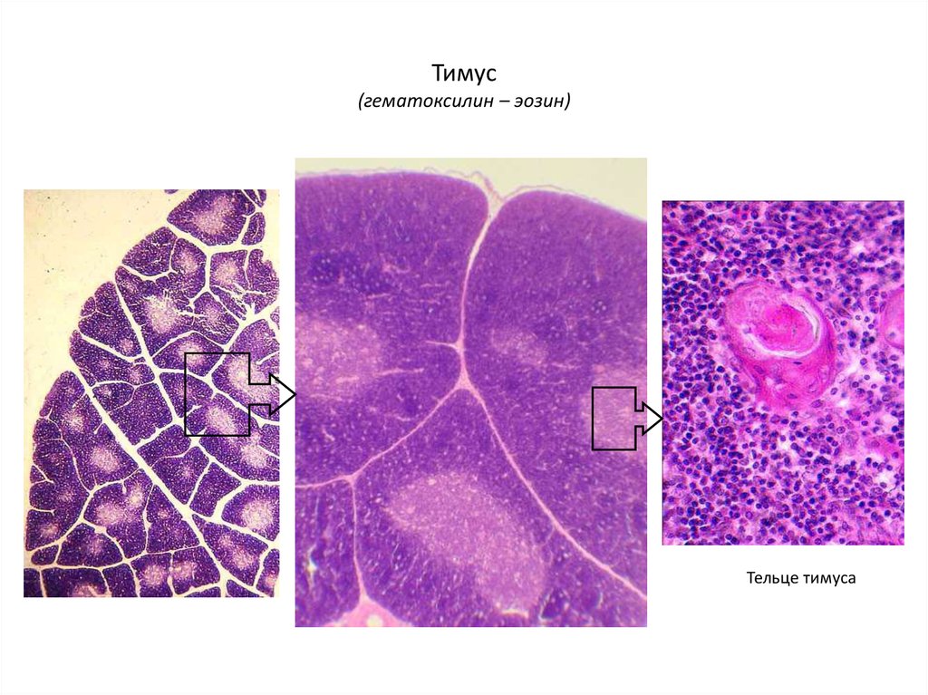 Тимус гематоксилин эозин рисунок