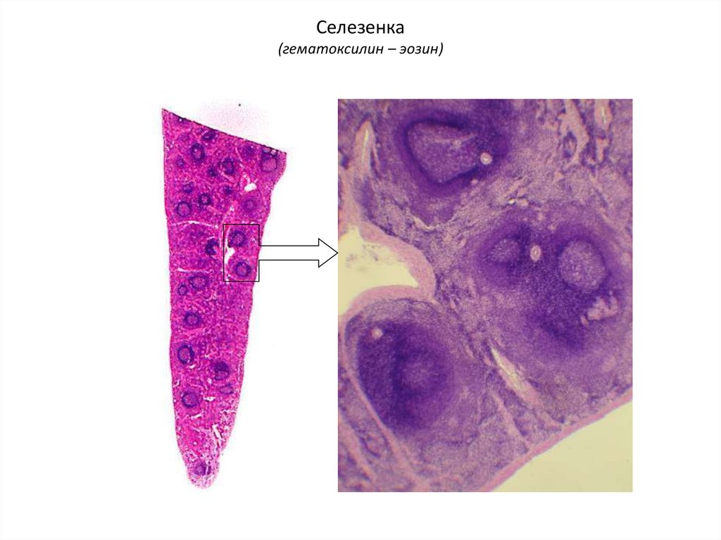 Селезенка гистология презентация