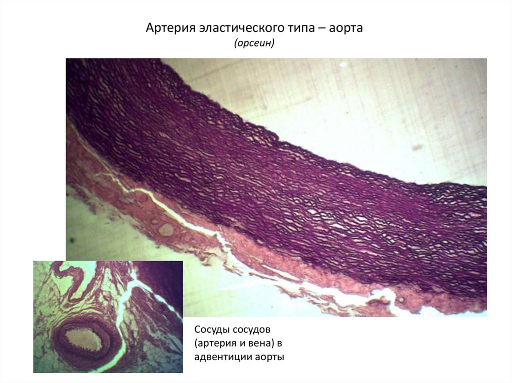 Аорта рисунок гистология