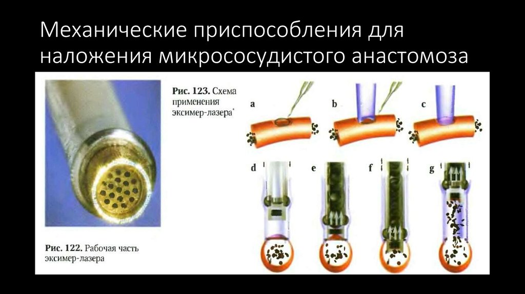 Лоскуты на микрососудистом анастомозе применяемые в челюстно лицевой хирургии презентация