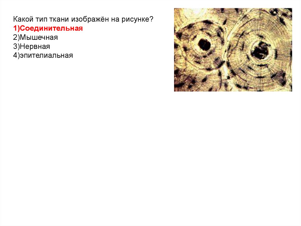 Рассмотрите ткани. Какие виды соединительных тканей изображены на рисунке. Какой Тип ткани изображён на рисунке?. Какие ткани изображены на картинке?. Какой вид ткани изображен на рисунке.