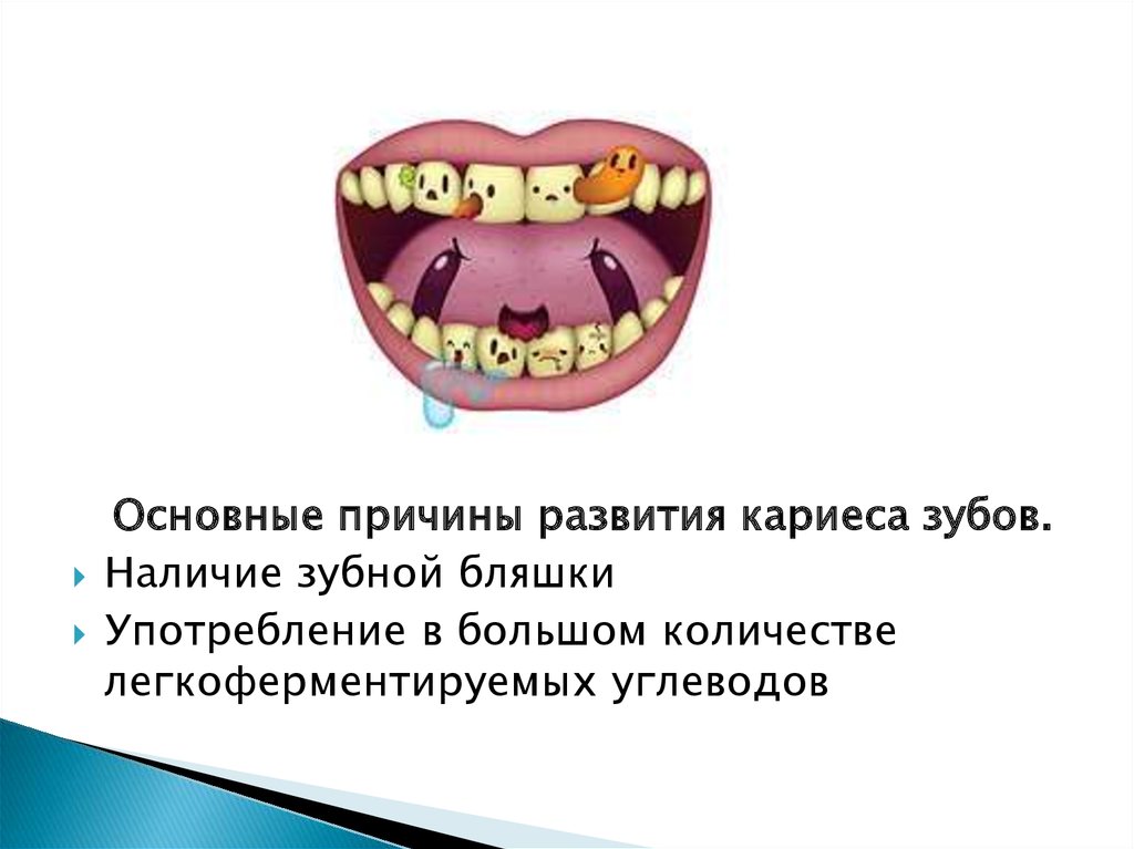 Зубов причины. Кариес причины возникновения. Кариес зубов причины возникновения. Основная причина кариеса. Факторы возникновения кариеса зубов.