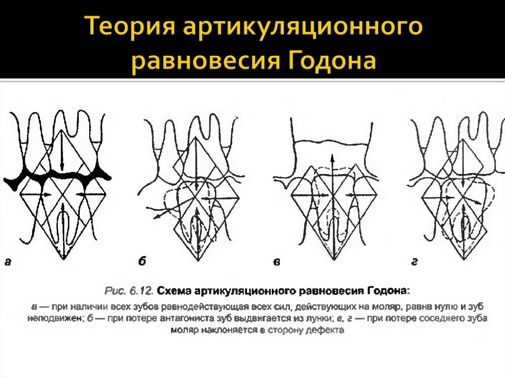 Теория равновесия. Схема артикуляционного равновесия Годона. Артикуляционная теория Годона. Основные положения теории артикуляционного равновесия Годона. Артикуляционный баланс Годона,.