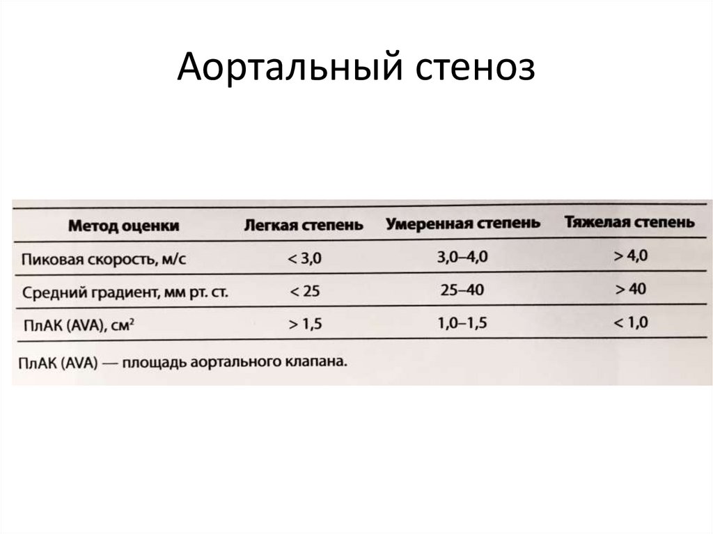 Аортальный стеноз