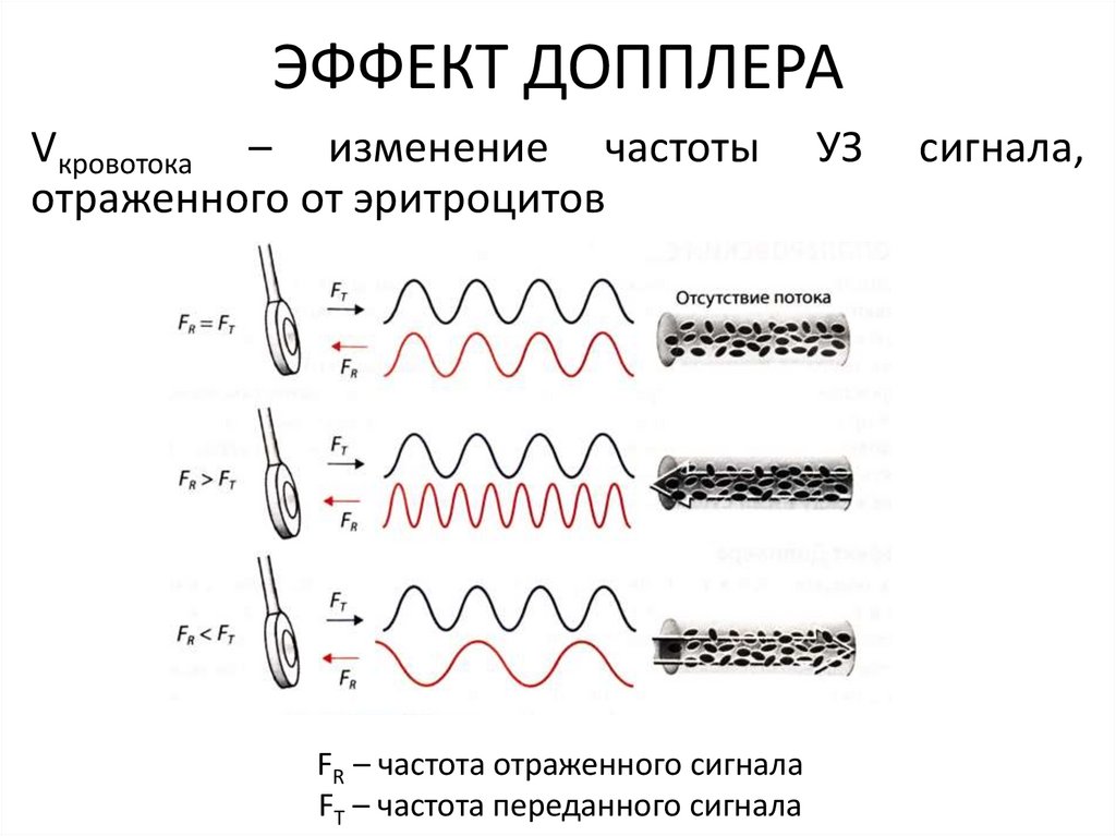 Суть доплера. Эффект Доплера схема. Эффект допплера для звуковых волн. Эффект Доплера в радиолокации. Эффект Доплера изменение частоты.