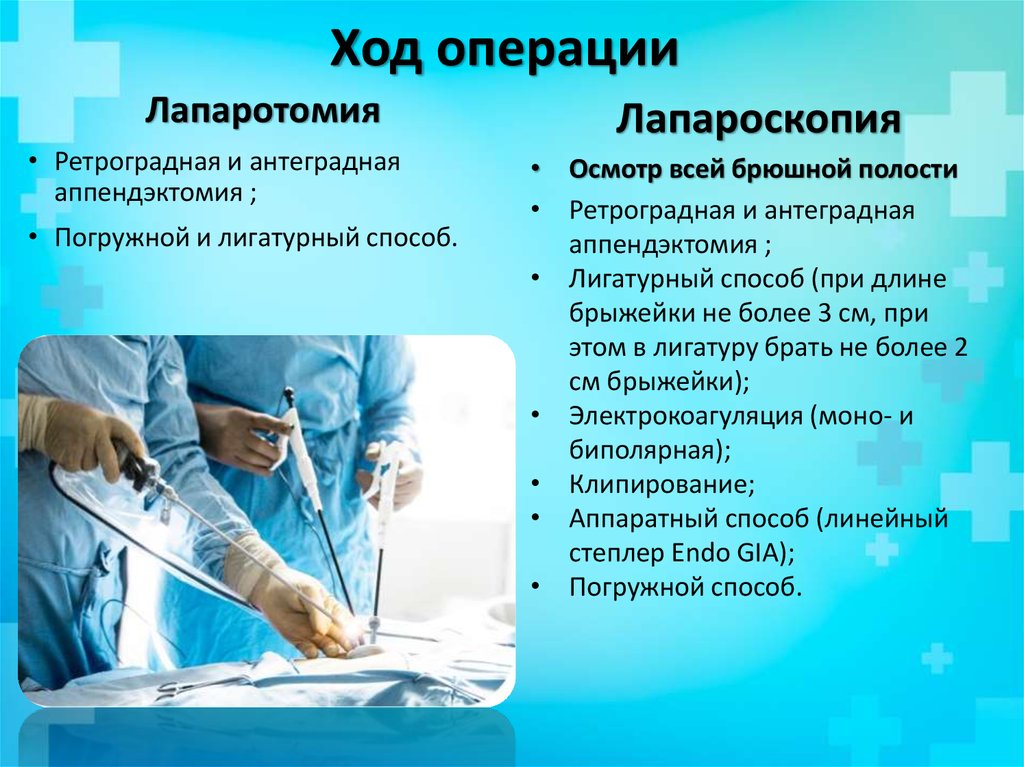 Ход операции