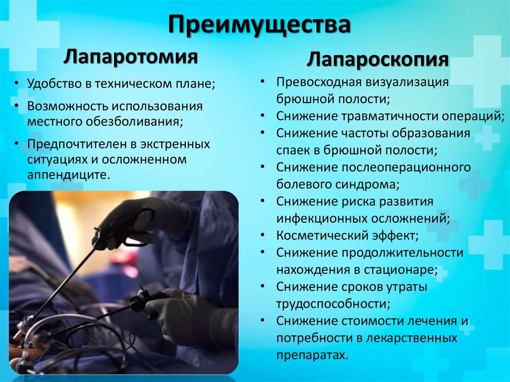 Преимущества