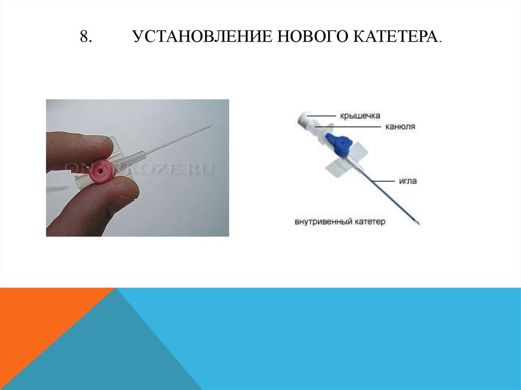 В вену ставят. Катетер для внутривенного введения. Введение препарата в катетер. Поставить внутривенный катетер. Постановка внутривенного катетера.