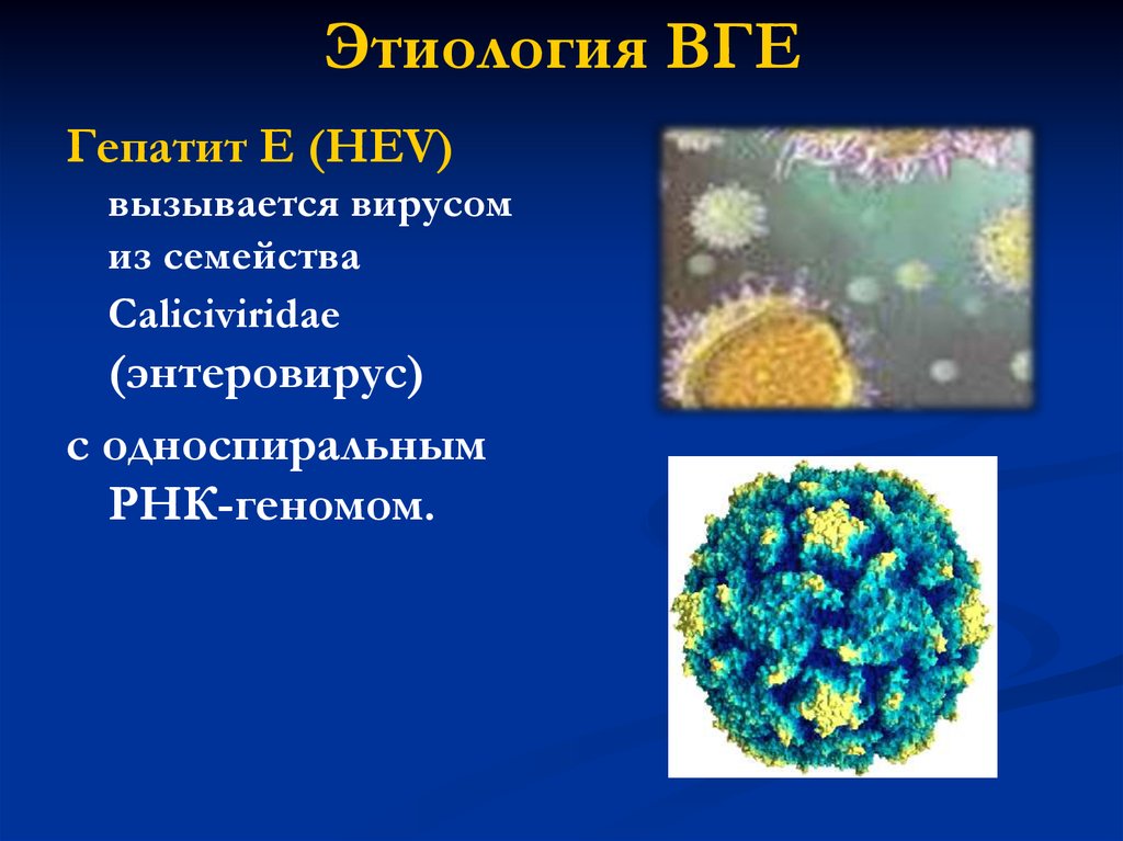 Кишечные инфекции вирусный гепатит. Вирус гепатита е этиология. Этиология ВГЕ. Гепатит с этиология. Вирус гепатита а этиология.