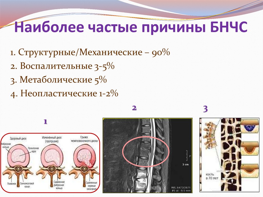 Наиболее частая причина