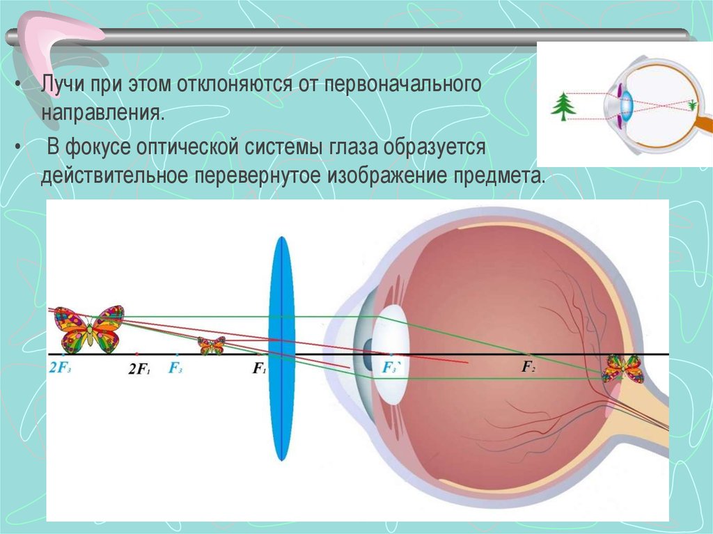 Какой части глазного яблока образуется изображение предмета. Аккомодация зрения механизм. Механизм аккомодации хрусталика. Аккомодация глазного яблока. Рефракция и аккомодация глаза.