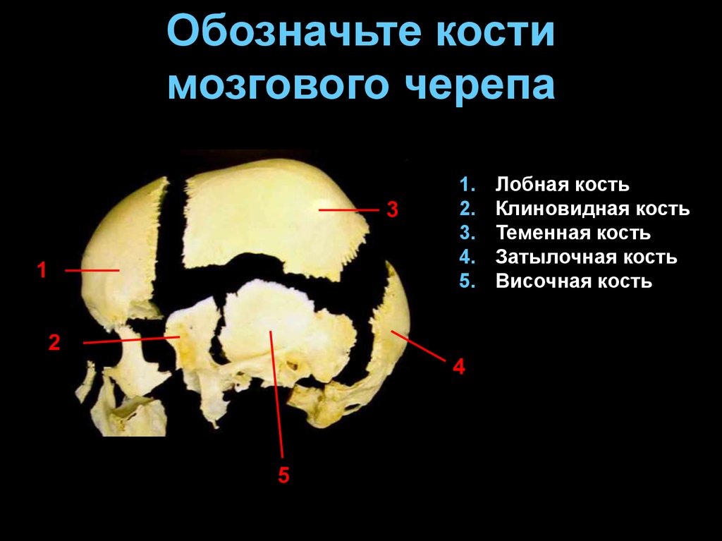 Соединение мозгового черепа