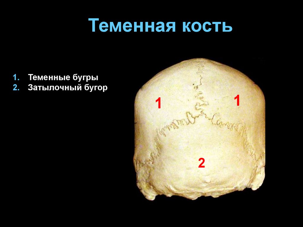 Левая теменная кость. Теменные кости черепа. Бугорок теменной кости.