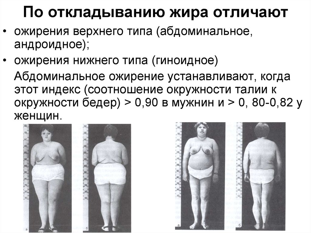 Виды ожирения живота у женщин фото и пояснениями