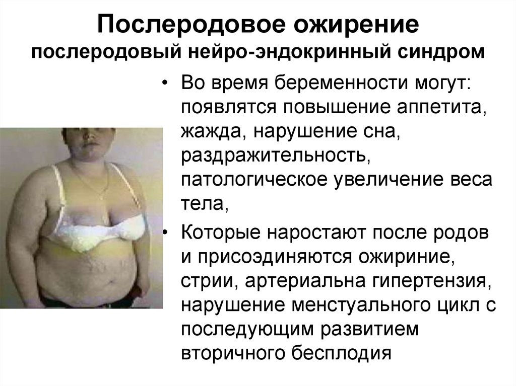 Забеременеть при гормональной. Ожирение. Послеродовое ожирение. Послеродовый метаболический синдром. Заболевания при избыточном весе.