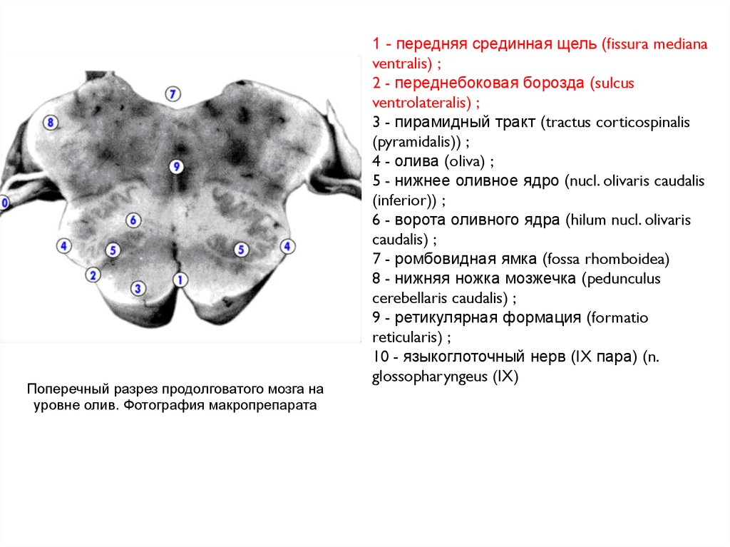 Спинной продолговатый мозг. Sulcus ventrolateralis продолговатого мозга. Срединная щель продолговатого мозга. Fissura mediana anterior продолговатого мозга. Передняя срединная щель продолговатого мозга.