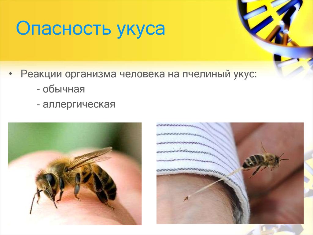 Укус пчелы человека. Пчела опасность для человека. Памятка при укусе пчелы.