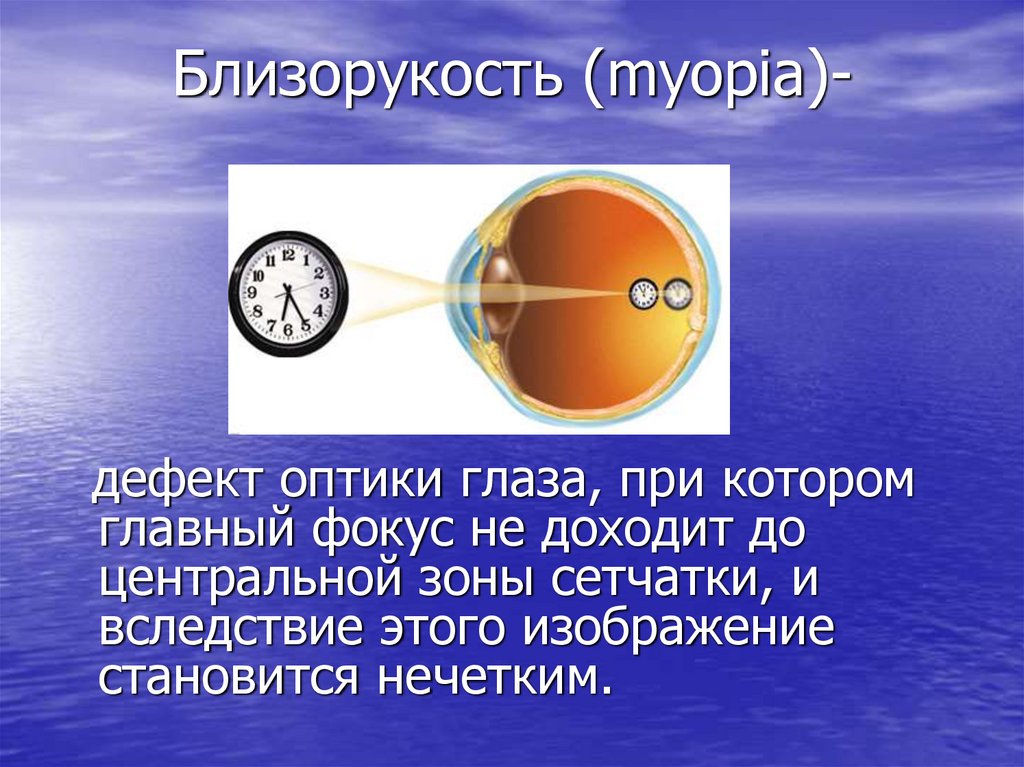 Презентация на тему близорукость и дальнозоркость физика презентация