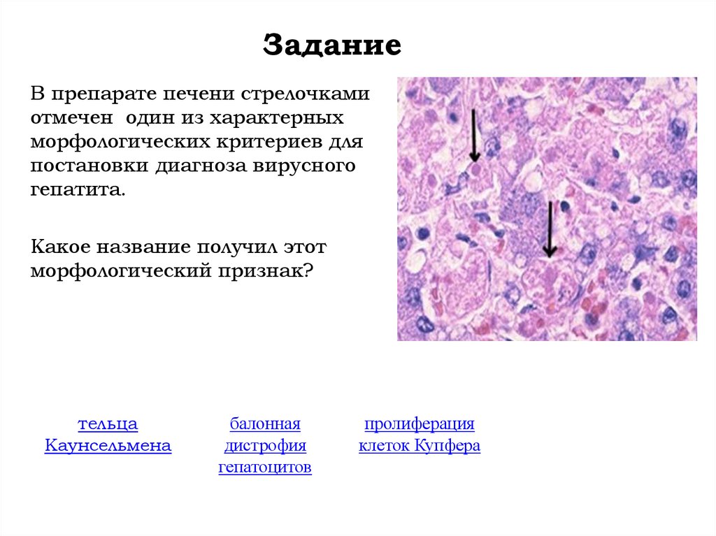 Презентация курсовая заболевание печени.