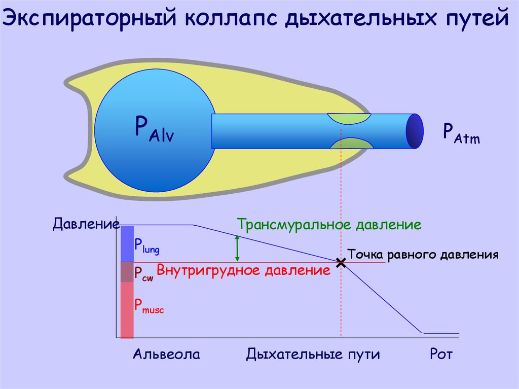 Экспираторный коллапс. Дыхательный коллапс. Трансмуральное давление. Экспираторный коллапс лёгких.