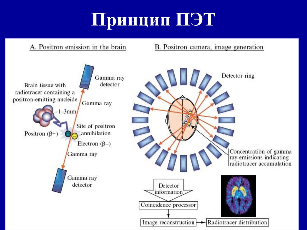 Принципы получения изображения пэт