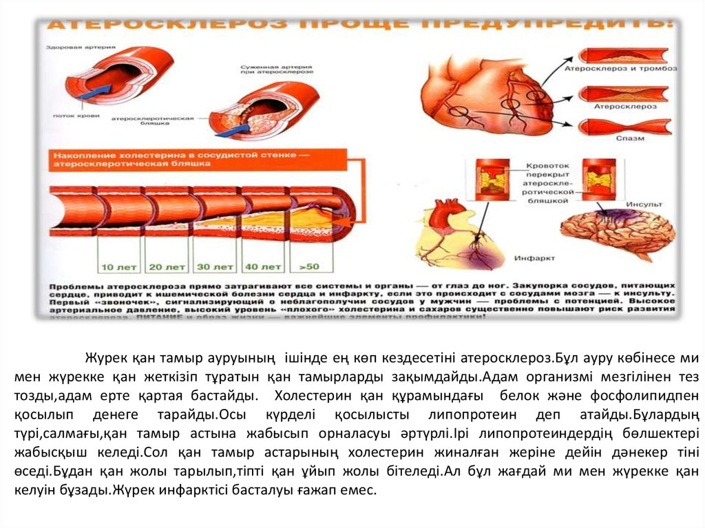 Сестринский уход при атеросклерозе презентация