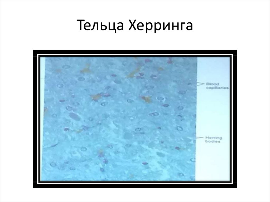 Тельца Херринга