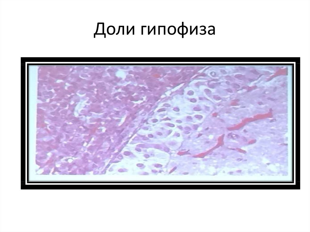 Доли гипофиза