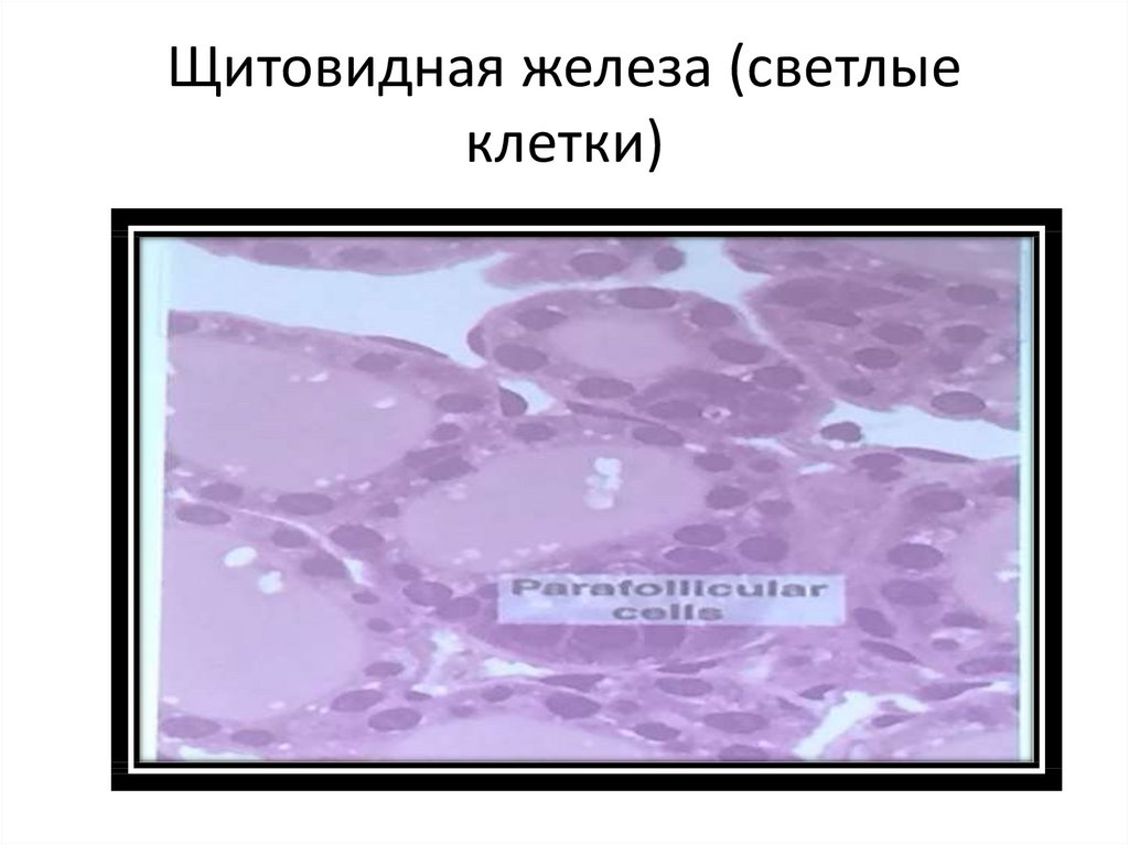Щитовидная железа (светлые клетки)