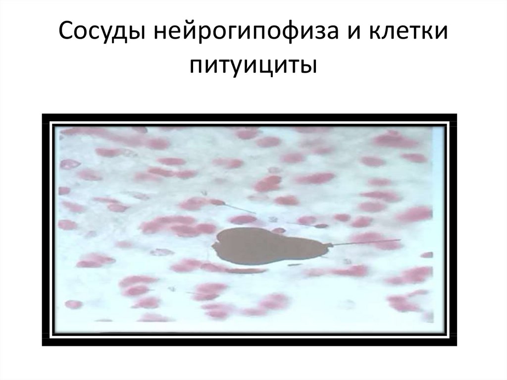 Сосуды нейрогипофиза и клетки питуициты