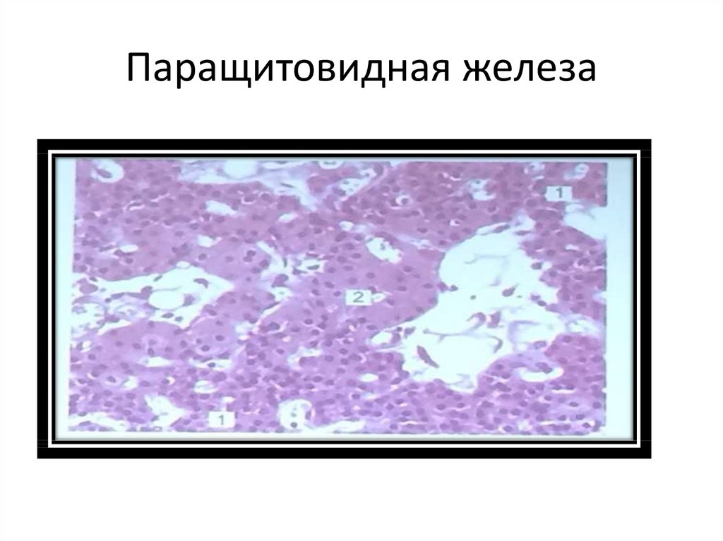 Паращитовидная железа