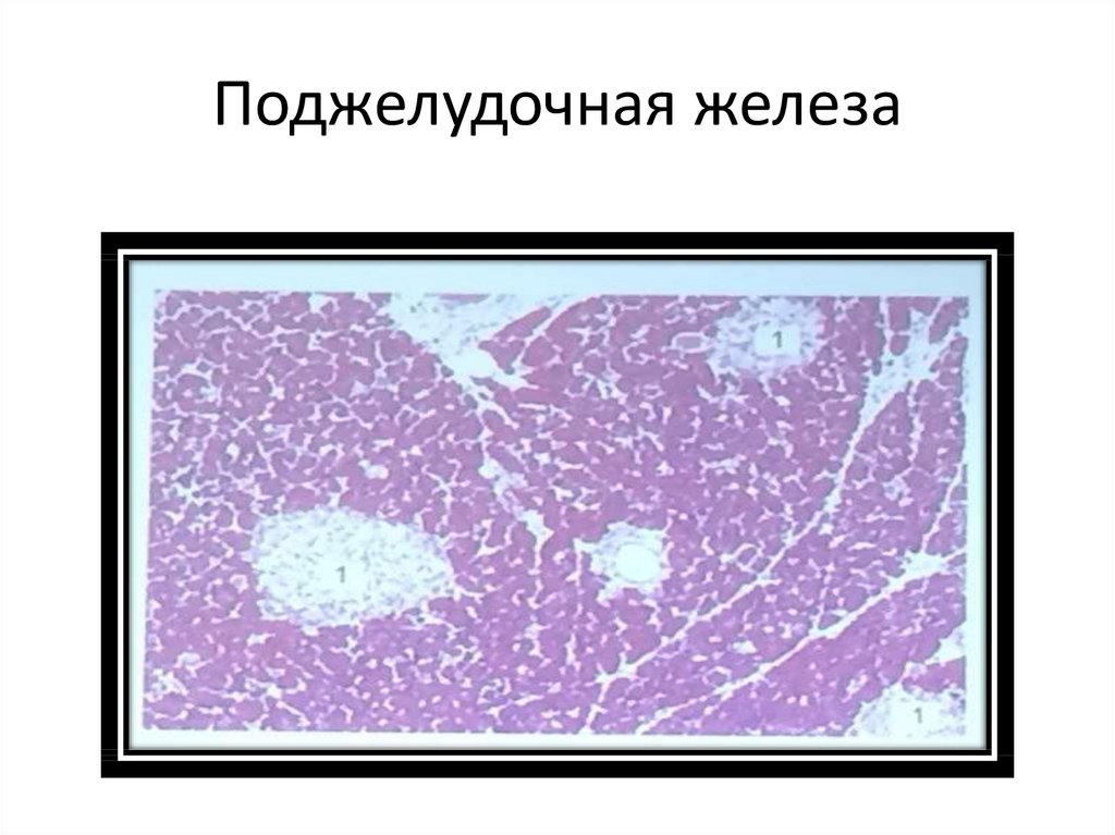 Поджелудочная железа