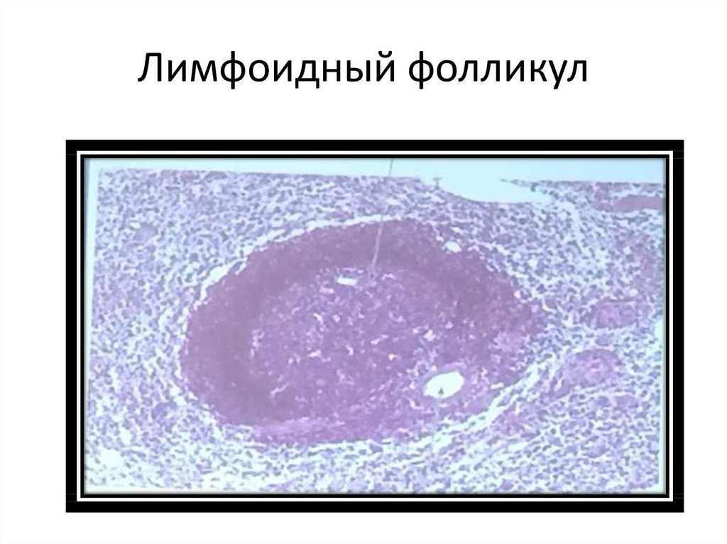 Лимфоидные фолликулы. Лимфатические фолликулы. Лимфоидные фолликулы строение. Лимфоидный фолликул гистология. Лимфоидный фолликул гистология кишечника.