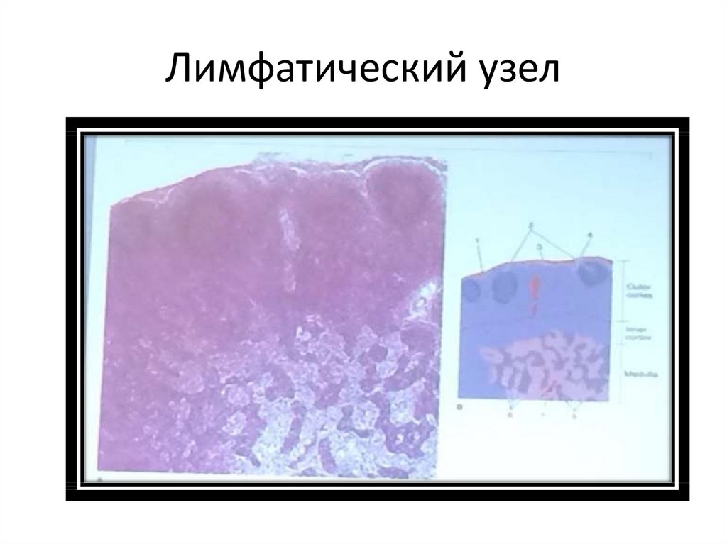 Лимфатический узел