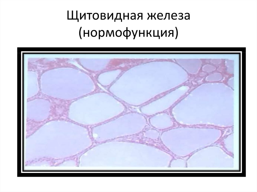 Щитовидная железа (нормофункция)
