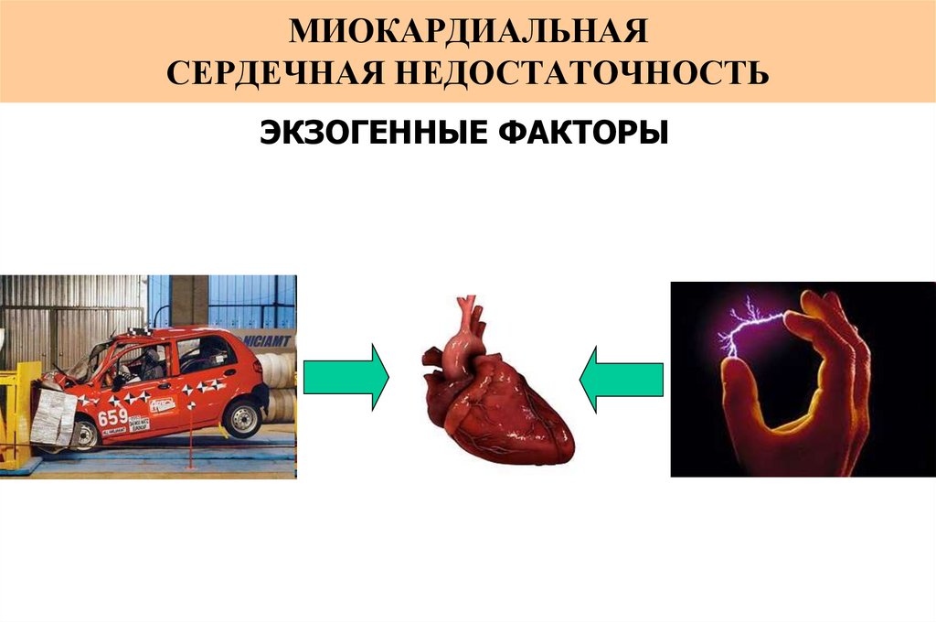 Миокардиальная сердечная недостаточность. Сердечная недостаточность миокардиальная форма. Миокардиальная форма сердечной недостаточности этиология. Миокардиальная форма сердечной недостаточности патофизиология. Миокардиальная и перегрузочная сердечная недостаточность формы.