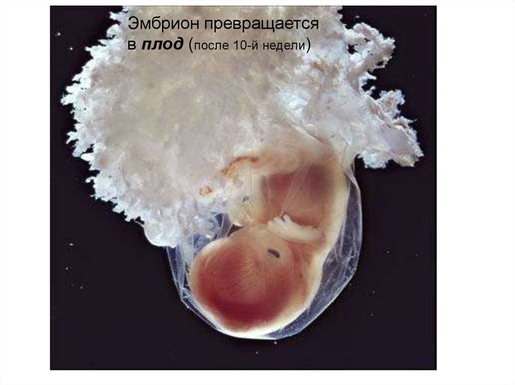 Эмбрион 4 недели. Эмбрион в реальной жизни. Как выглядит эмбрион в живую.