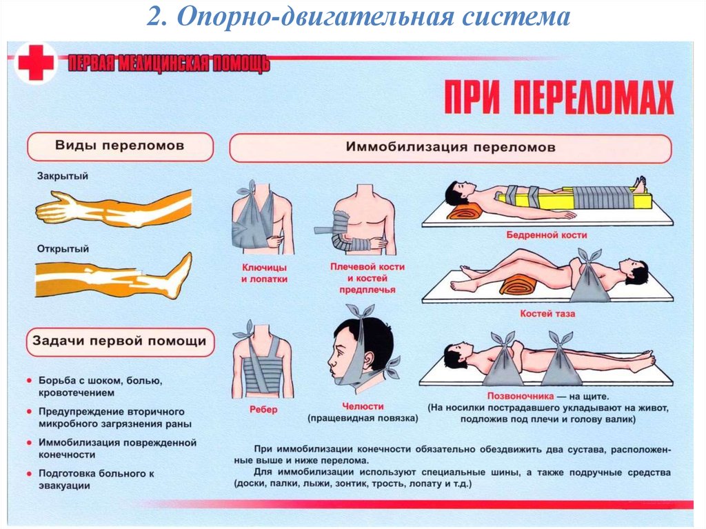 Шок от боли. Алгоритм оказания первой помощи переломы конечностей. Перелом и оказание первой медицинской помощи при переломе. Оказание первой медицинской помощи при ранениях и закрытых травмах. Порядок первой мед помощи при переломе.