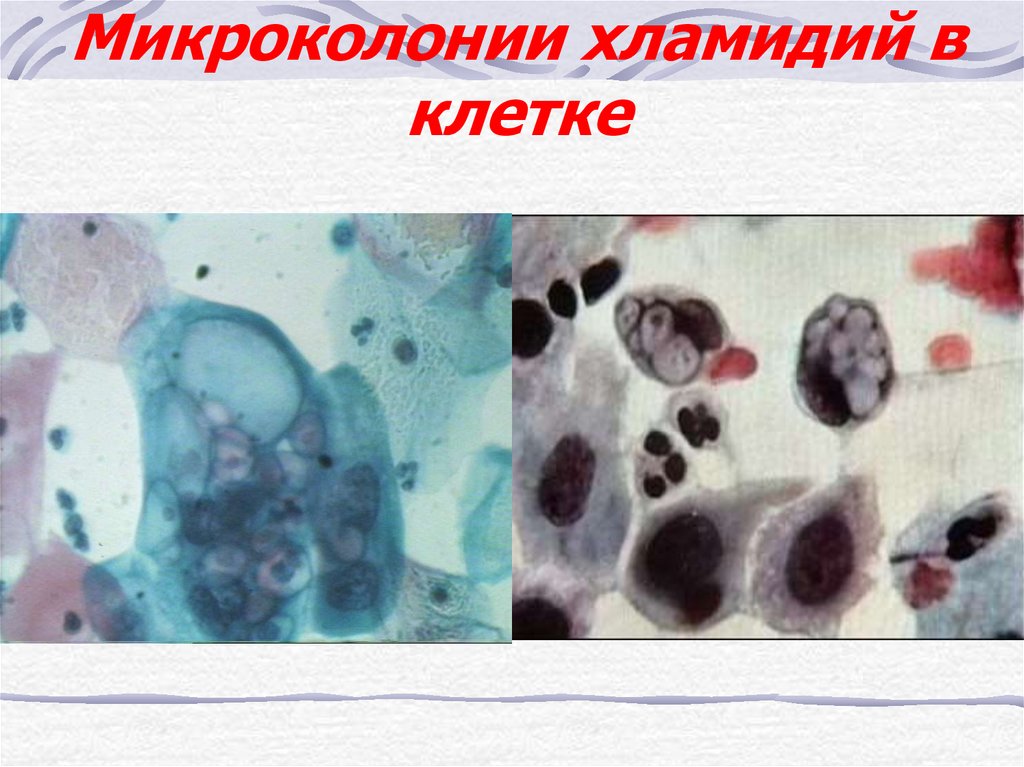 Хламидий результат. Хламидии микробиология. Возбудитель хламидиоза. Хламидии урогенитальный. Хламидийная инфекция цитология.