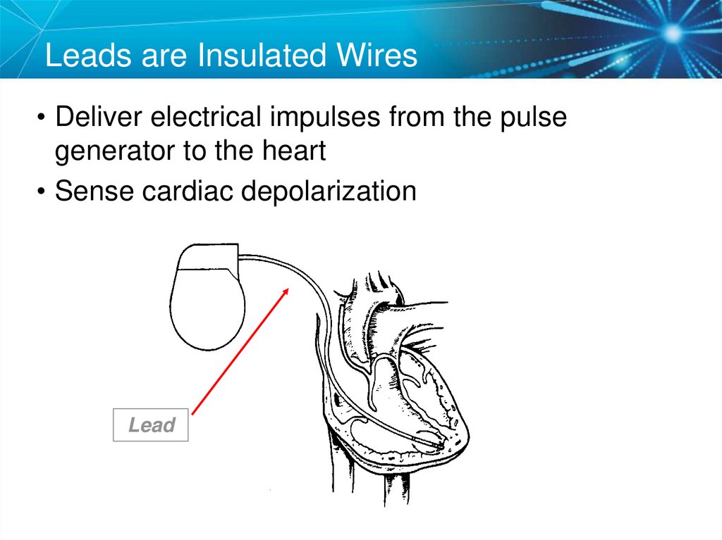 Leads are Insulated Wires