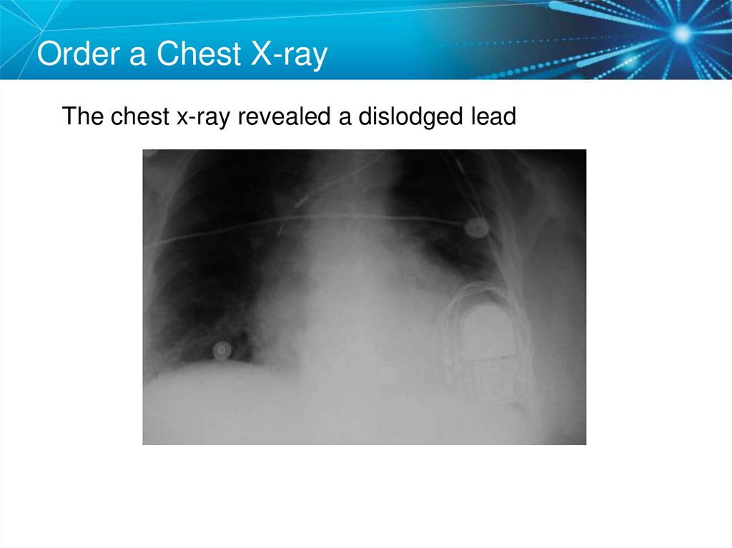 Order a Chest X-ray