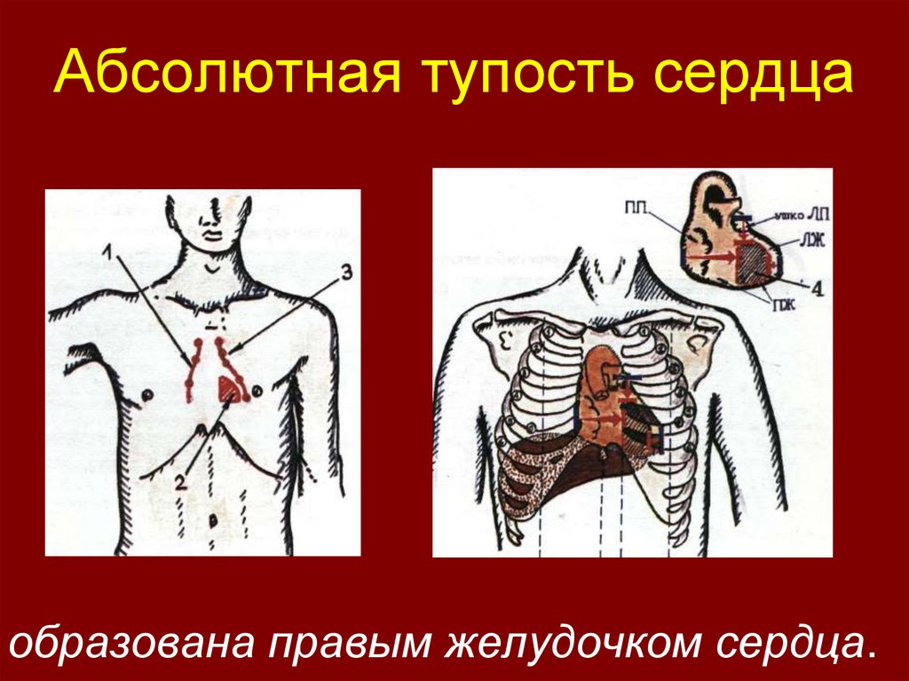 Границы абсолютной. Абсолютная сердечная тупость норма. Границы абсолютной тупости сердца. Границы абсолютной тупости сердца в норме. Относительная и абсолютная тупость сердца в норме.