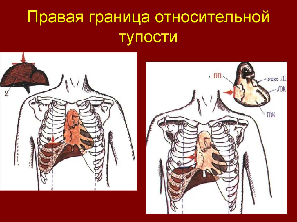 Поперечник относительной тупости сердца