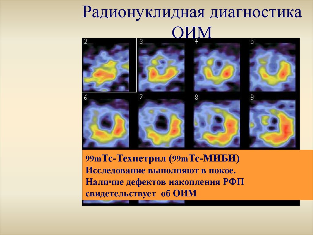 Радионуклидная диагностика. Радионуклидная диагностика недостатки. Радионуклидные методы в кардиологии. Радионуклидная диагностика презентация.