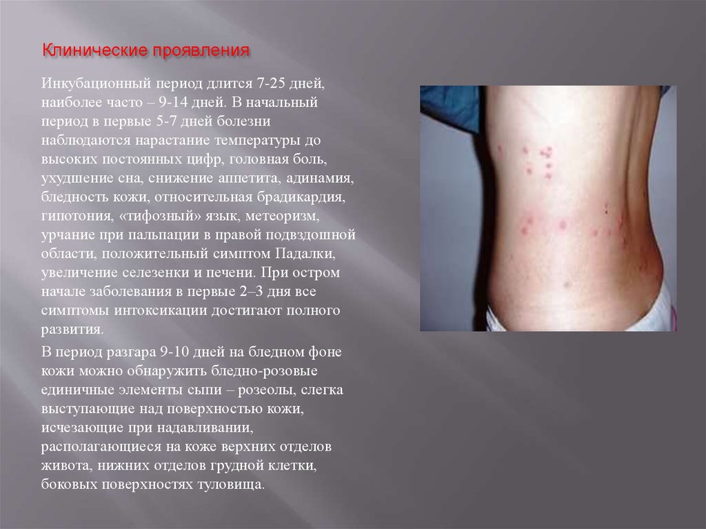 Клинические проявления